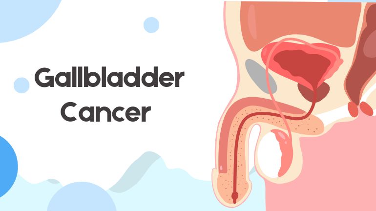 Bladder Cancer