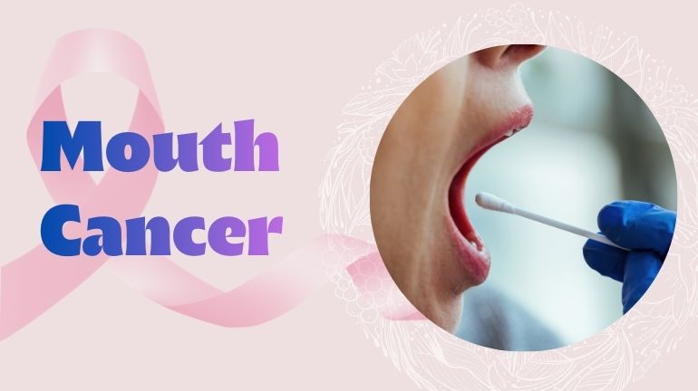 Mouth Cancer