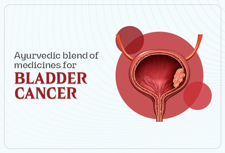 ayurvedic-medicines-for-bladder-cancer