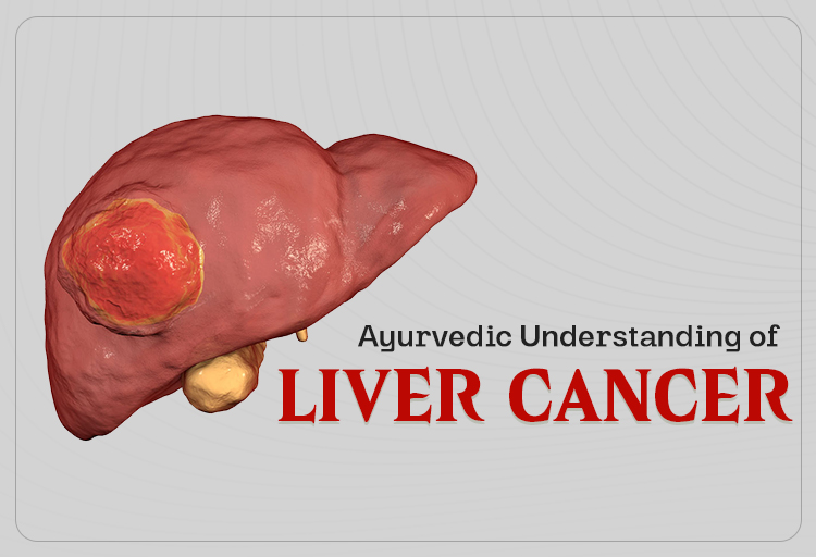 Ayurvedic Understanding of Liver Cancer