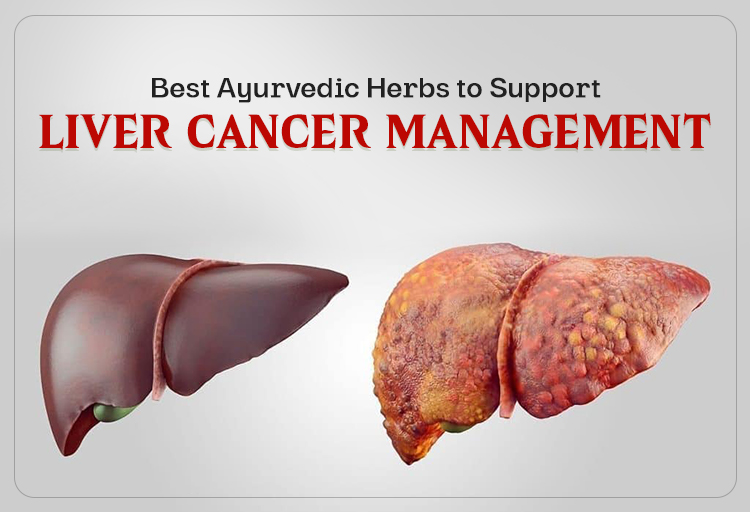 Best Ayurvedic Herbs to Support Liver Cancer
