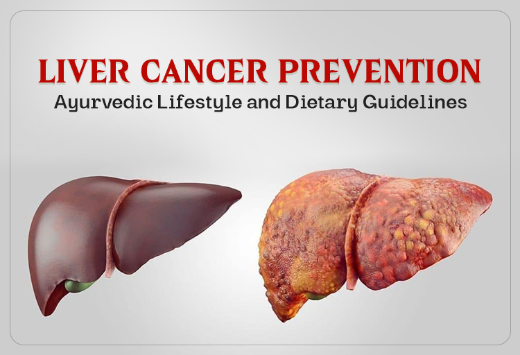 Liver Cancer Prevention: Ayurvedic Lifestyle