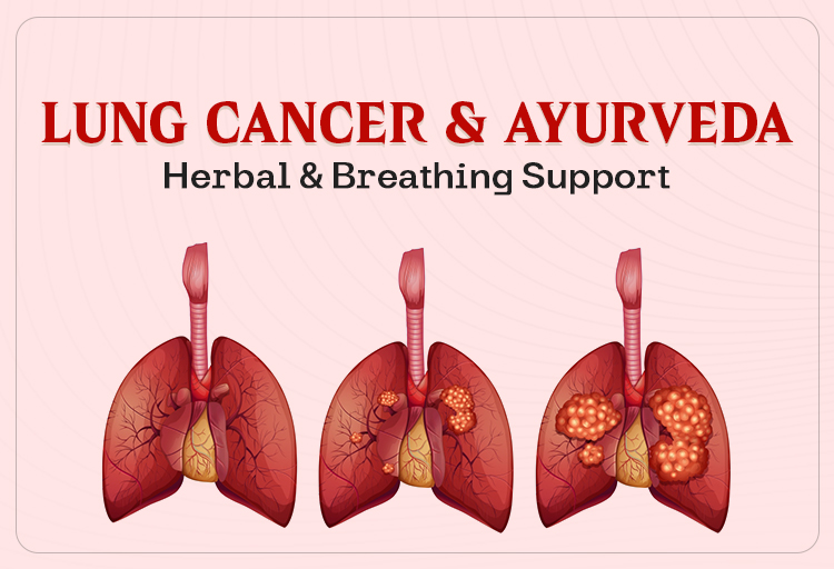 Lung Cancer & Ayurveda: Herbal & Breathing Support
