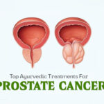 ayurvedic-treatment-for-prostate-cancer